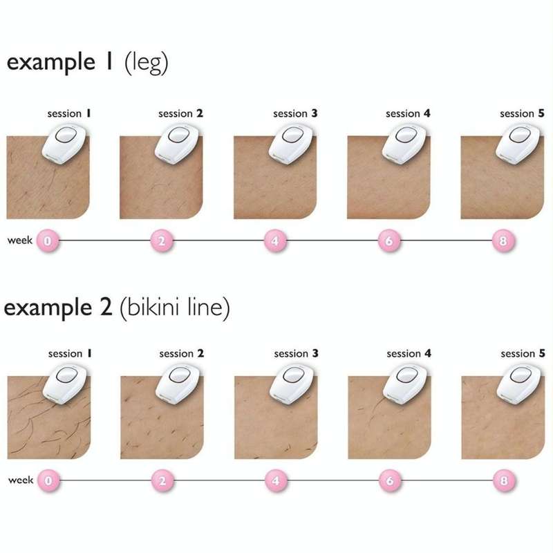 Aimanfun 100000 Flash Professional IPL Epilator Laser Hair Removal Women Painless Threading Hair ...