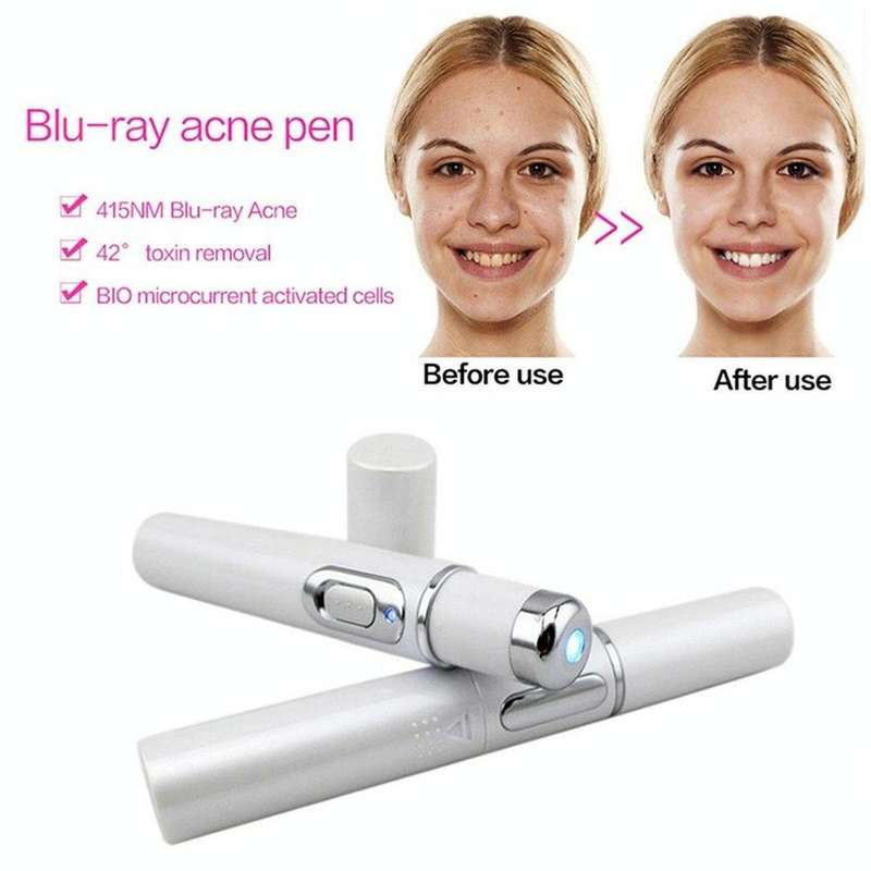 K-SKIN KD-7910 Acne Laser Pen Portable Wrinkle Removal Machine Durable Soft Scar Remover Device B...
