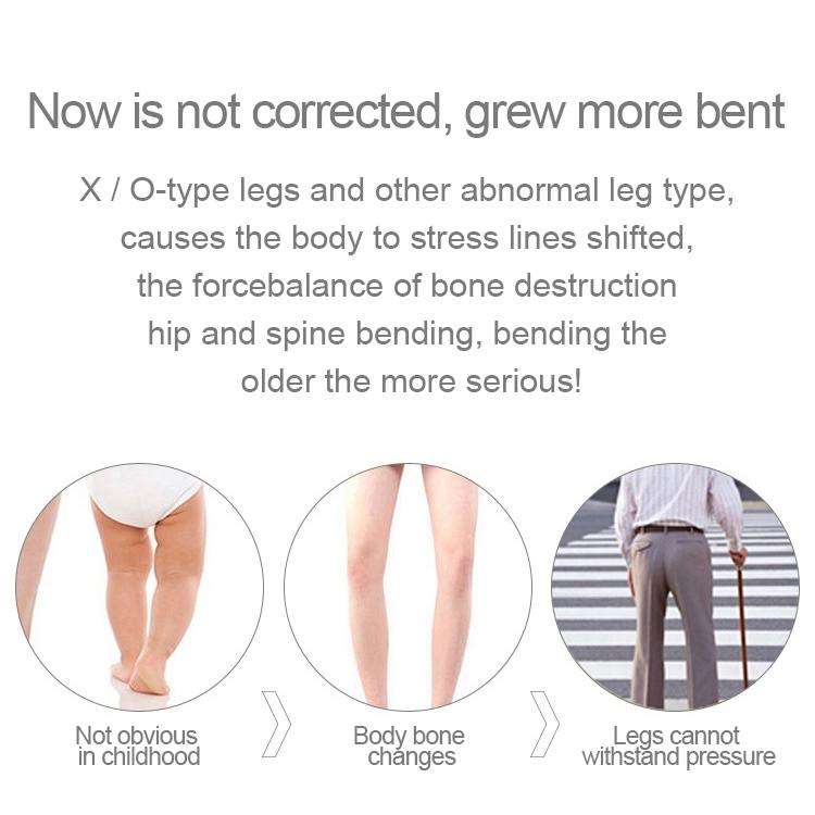 3 PCS/Set Leg Posture Corrector O/X-type Bowlegs Orthotic Bandage Straightening Belt Band, Size: ...