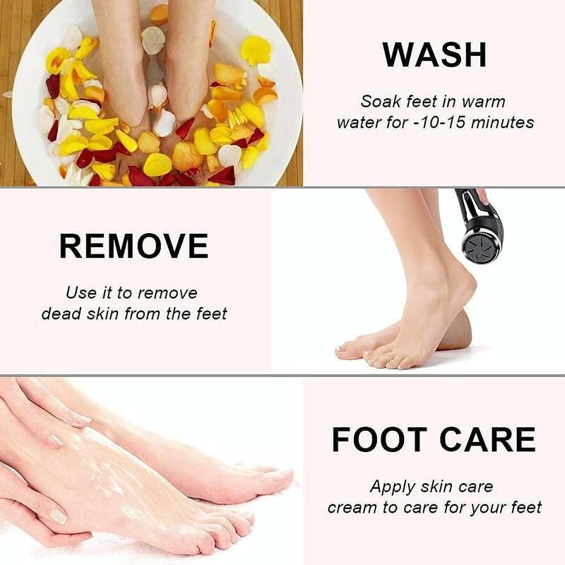 JD-510 Rechargeable Electric Foot Callus Remover with Vacuum Cleaner White