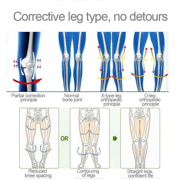 3 PCS/Set Leg Posture Corrector O/X-type Bowlegs Orthotic Bandage Straightening Belt Band, Size: ...
