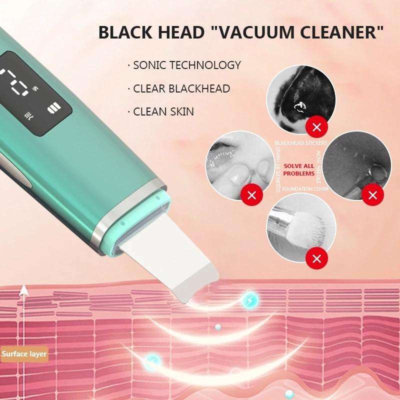 Ultrasonic Shoveling Machine Blackhead Beauty Instrument Iontophoresis Pore Cleaning Instrument(W...