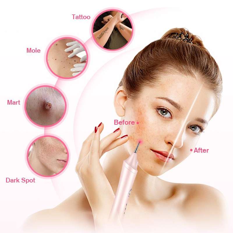 K-SKIN KD306 Laser Spotting Machine Plasma Pen Dark Eyelash Remover for Facial Spasm Removal Tatt...