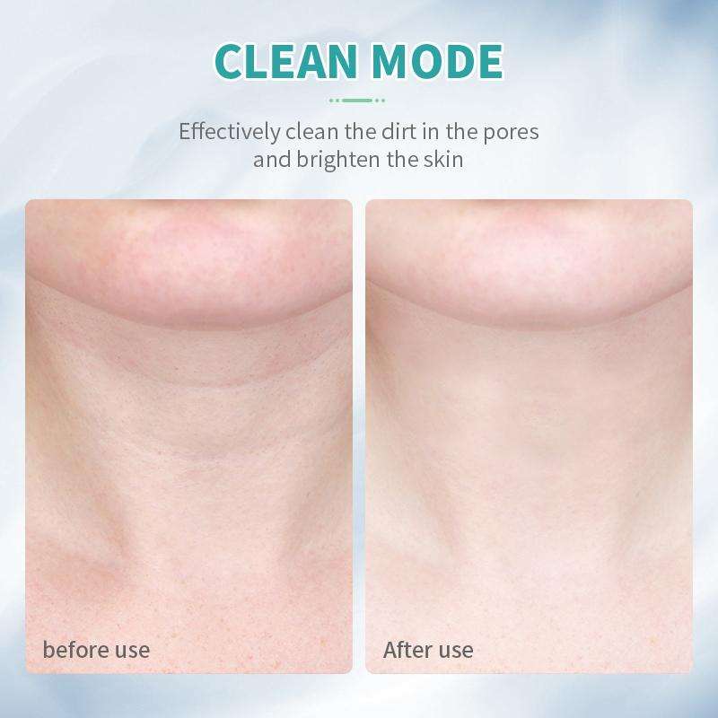 ANLAN LED Photon Therapy Neck Beauty Device