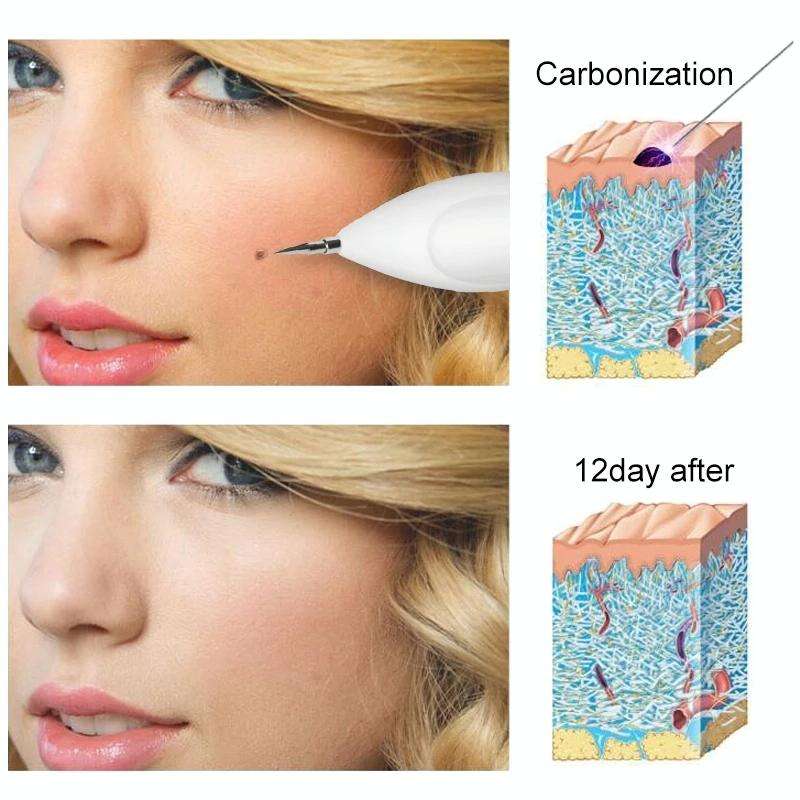 Dark Spot Remover USB Laser Plasma Pen Facial Freckle Wart Removal Beauty Care Device