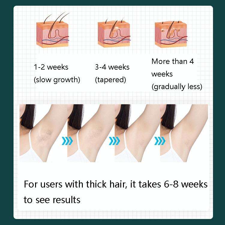 FY-B500 Laser Hair Removal Equipment Household Electric IPL Hair Removal Machine, Plug Type:EU Pl...