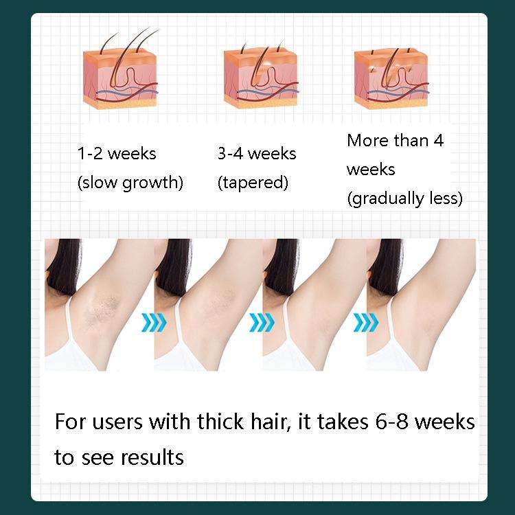 FY-B500 Laser Hair Removal Equipment Household Electric IPL Hair Removal Machine, Plug Type:AU Pl...