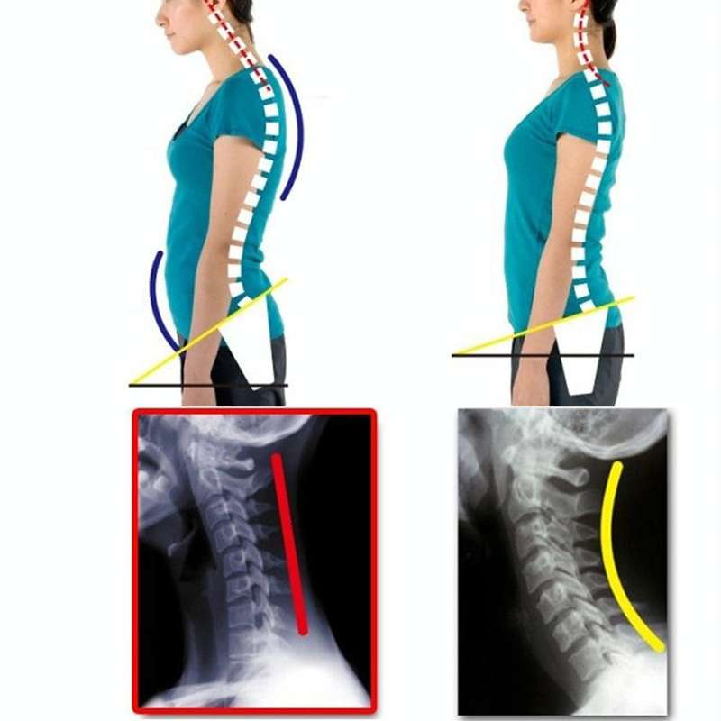 Adjustable Women Back Posture Corrector Shoulder Support Brace Belt Health Care Back Posture Belt...