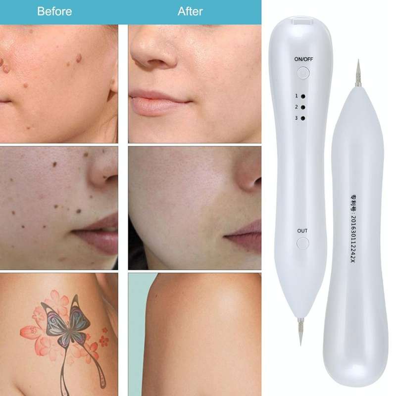 Dark Spot Remover USB Laser Plasma Pen Facial Freckle Wart Removal Beauty Care Device