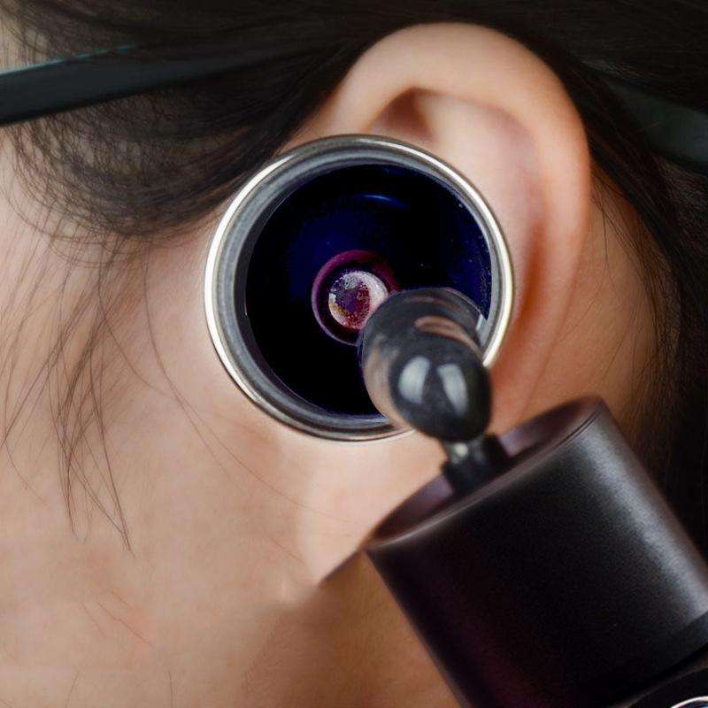 Ear Cleaning Hand Lamp USB Charging Otoscope(Black)