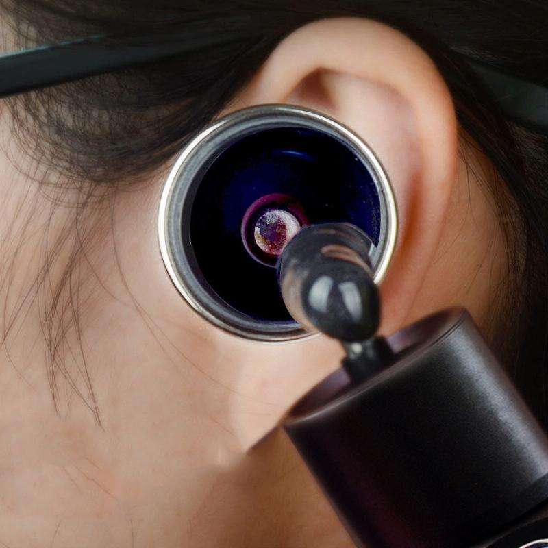 Ear Cleaning Hand Lamp USB Charging Otoscope(Elegant Gold)