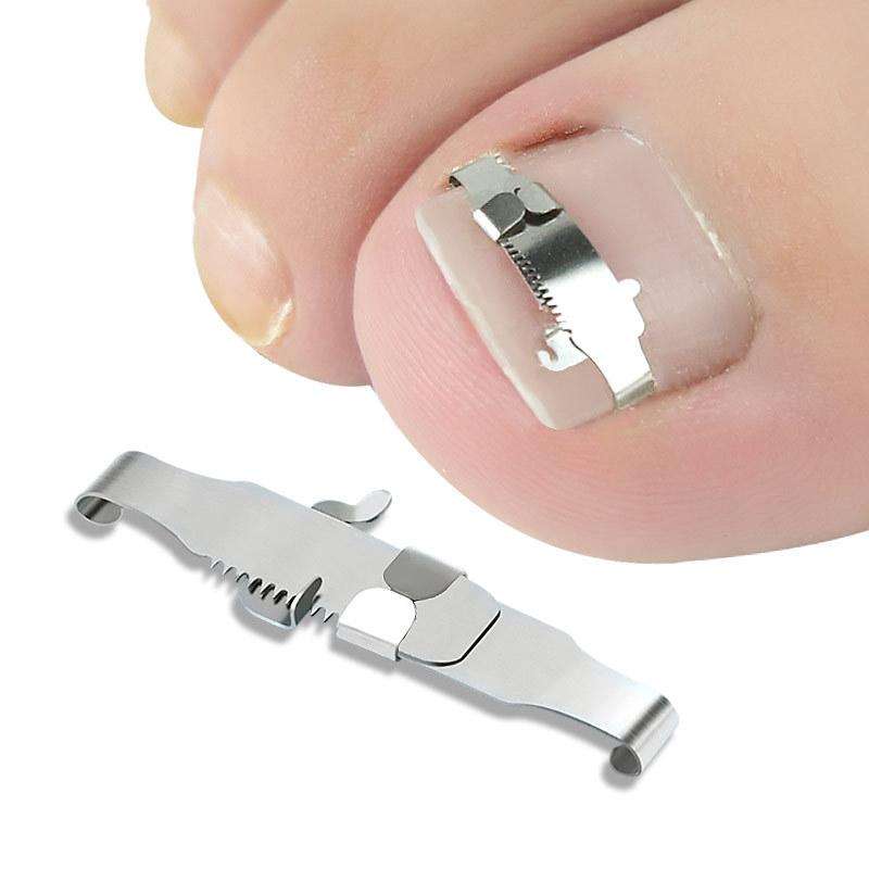 Orthopedic Buckle Toe Nail Groove Ingrown Nail Corrector, Style:No. 40, Specifications:Positive N...