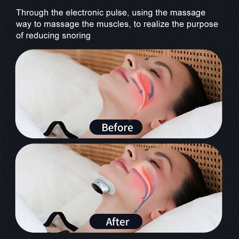 Smart Anti-snoring Device TENS Double Pulse Sound Wave Induction Sleep Snoring Breathing Correcto...