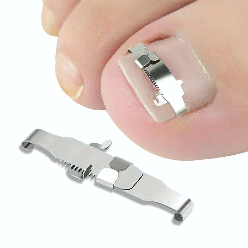 Orthopedic Buckle Toe Nail Groove Ingrown Nail Corrector, Style:No. 38, Specifications:Set