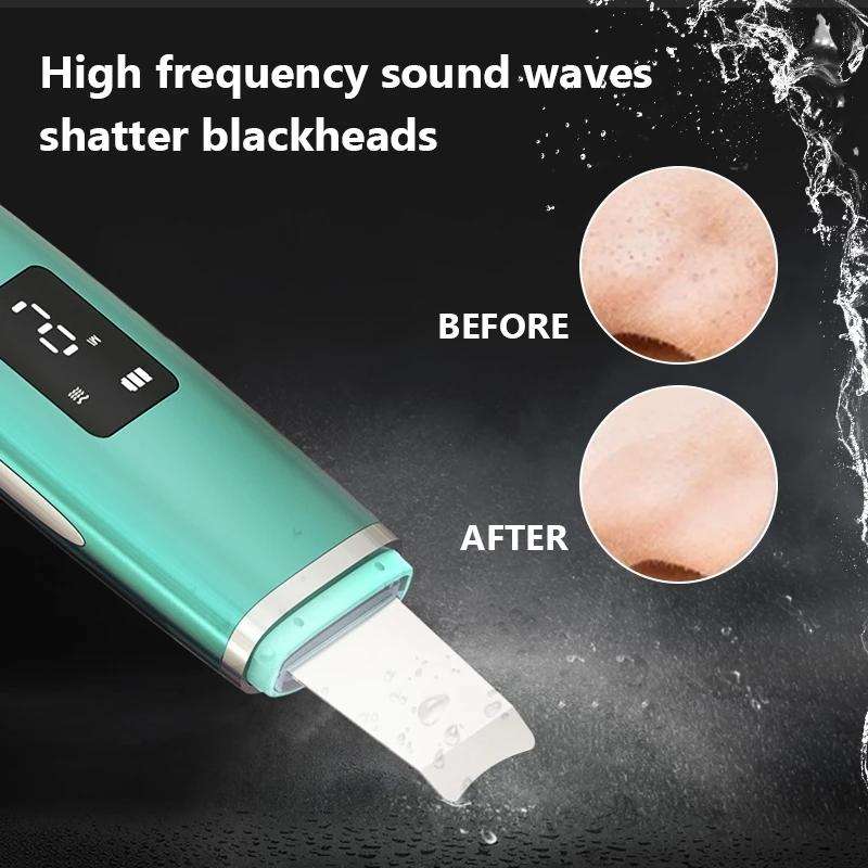 Ultrasonic Shoveling Machine Blackhead Beauty Instrument Iontophoresis Pore Cleaning Instrument(W...