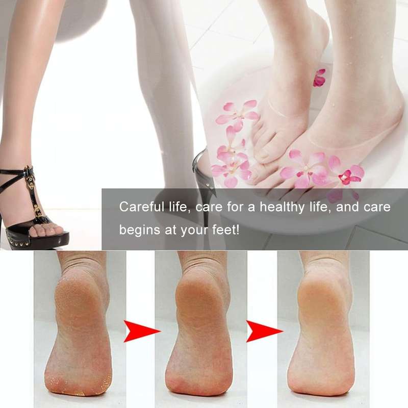 8 in 1 Dead Hard Skin Callus Remover Scraper Pedicure Rasp Tools Portable Cuticle Pusher Nail Foo...