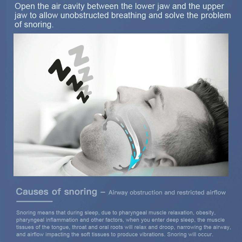 YJK100 Silicone + ABS Stop Snoring Device Anti Snore (White)