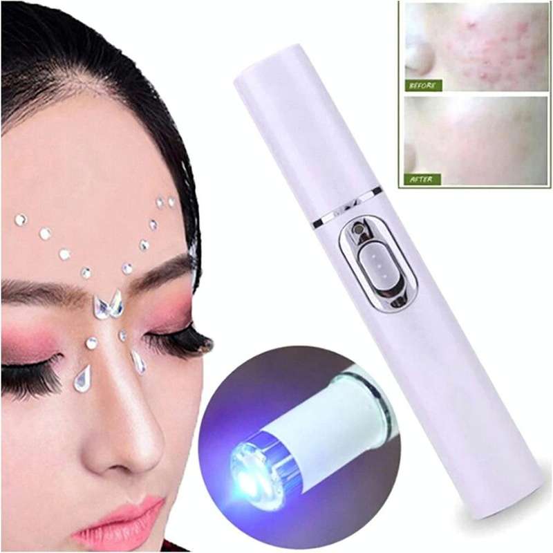 K-SKIN KD-7910 Acne Laser Pen Portable Wrinkle Removal Machine Durable Soft Scar Remover Device B...