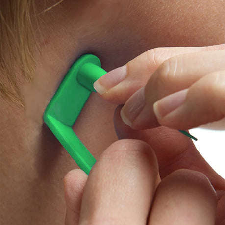 Skin Tag Removal Kit with Micro Bands