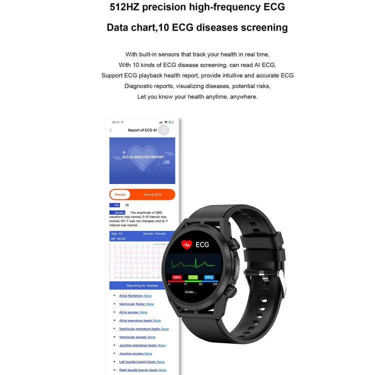 ET310 1.39 inch IPS Screen IP67 Waterproof Leather Band Smart Watch, Support Body Temperature Mon...