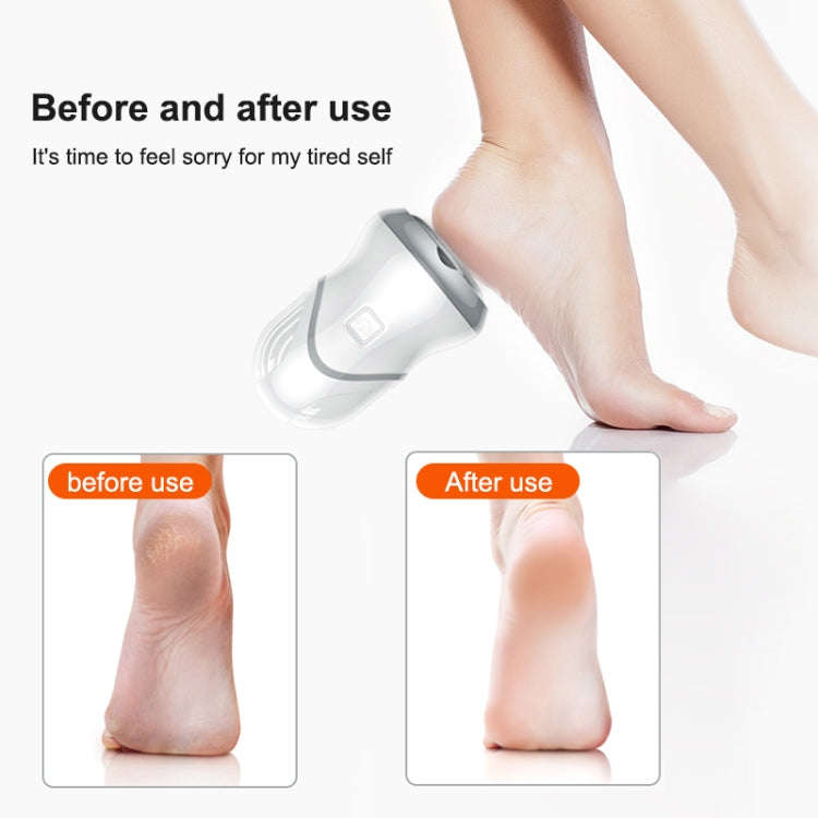 Electric Vacuum Design Foot Grinder Household Multifunctional Pedicure Calluses Foot Care, Specif...