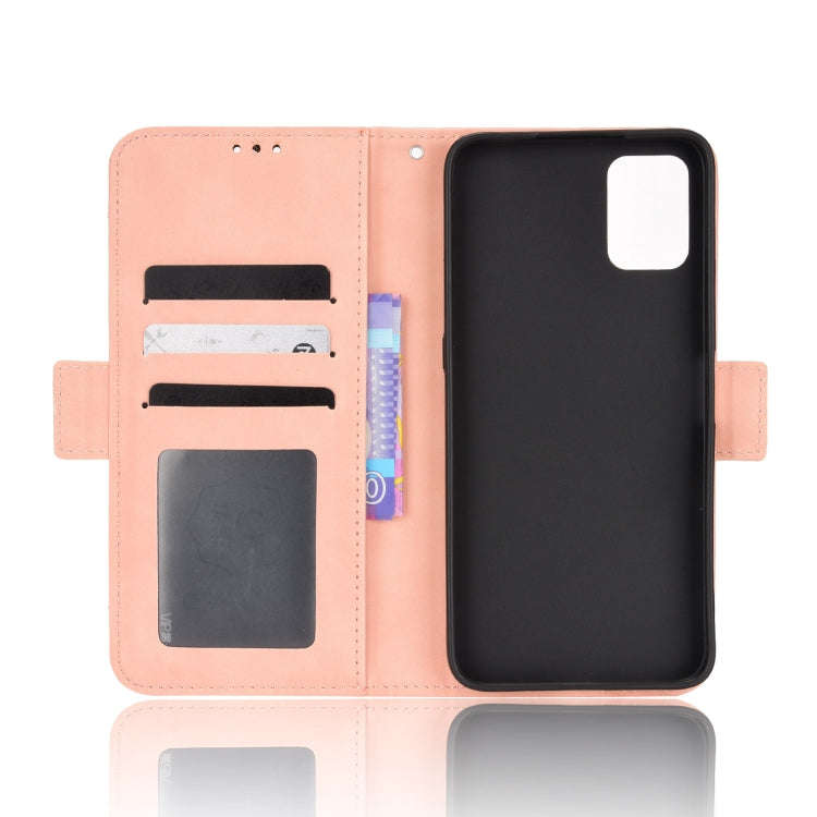 For Umidigi A11s Skin Feel Calf Pattern Leather Phone Case(Pink)
