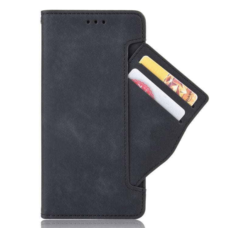 For Umidigi A11s Skin Feel Calf Pattern Leather Phone Case(Black)