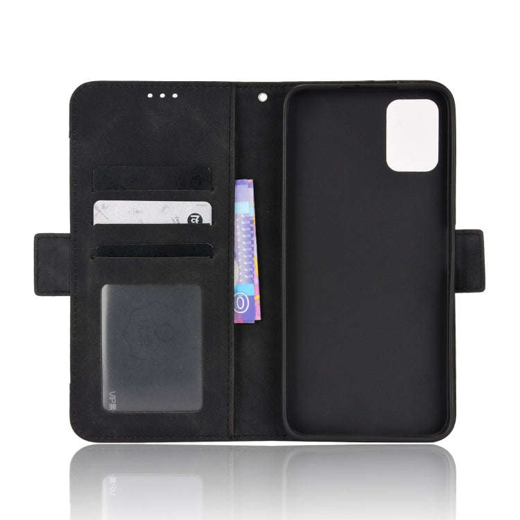 For Umidigi A11s Skin Feel Calf Pattern Leather Phone Case(Black)