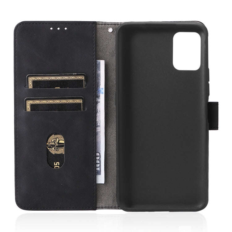 For Umidigi Power 5S Skin Feel Magnetic Buckle Calf Texture PU Phone Case(Black)