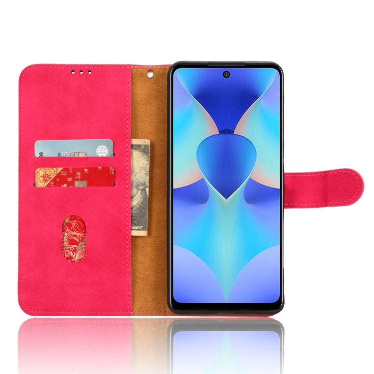 For TECNO Spark 10 Pro Skin Feel Magnetic Flip Leather Phone Case(Rose Red)