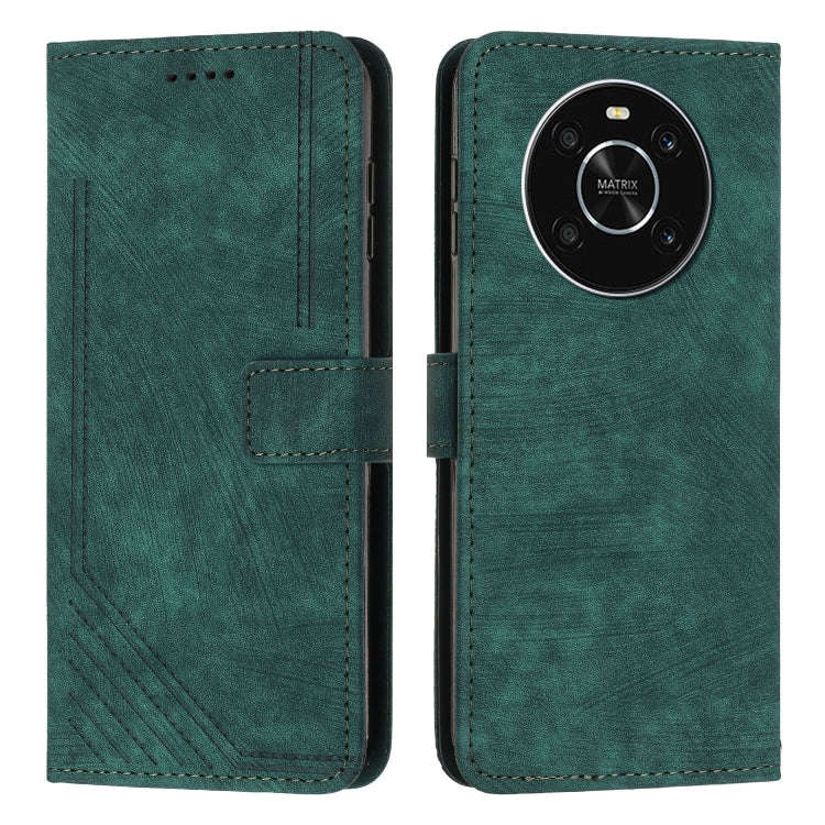 For Honor X9 5G&4G / X30 / Magic4 Lite Skin Feel Stripe Pattern Leather Phone Case with Lanyard(G...
