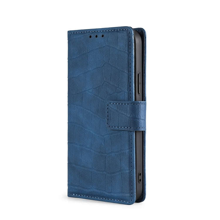 For Infinix Hot 11s NFC Skin Feel Crocodile Magnetic Clasp Leather Phone Case(Blue)