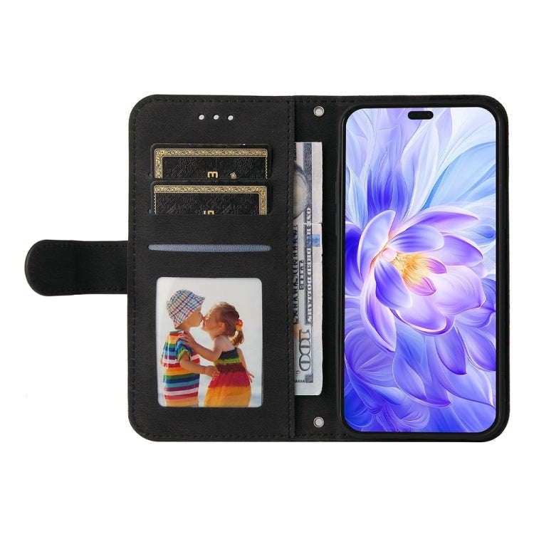 For Honor X60i Skin Feel Life Tree Metal Button Leather Phone Case(Black)