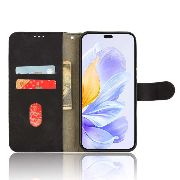 For Honor X60i 5G Skin Feel Magnetic Flip Leather Phone Case(Black)