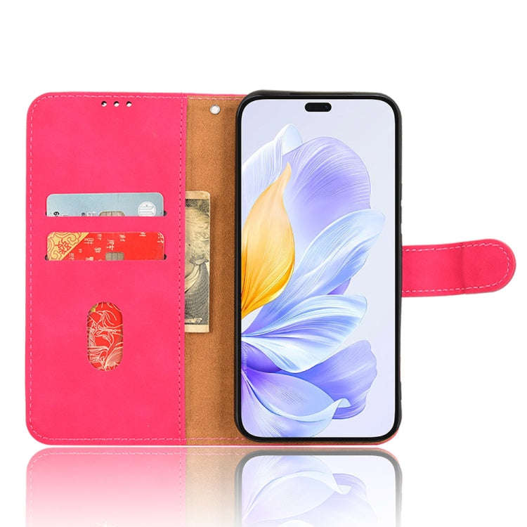 For Honor X60i 5G Skin Feel Magnetic Flip Leather Phone Case(Rose Red)