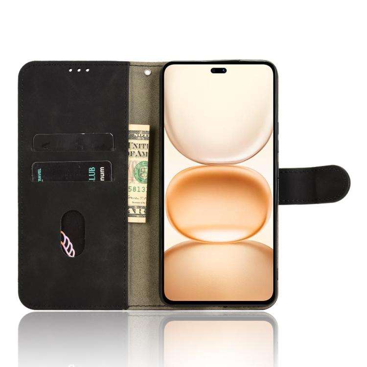 For Honor Power 5G Skin Feel Magnetic Flip Leather Phone Case(Black)