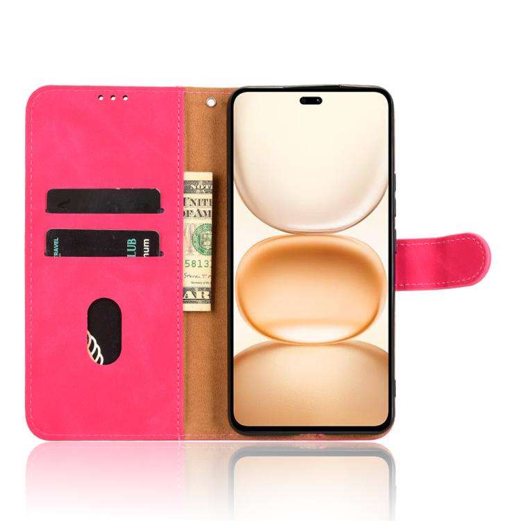For Honor Power 5G Skin Feel Magnetic Flip Leather Phone Case(Rose Red)