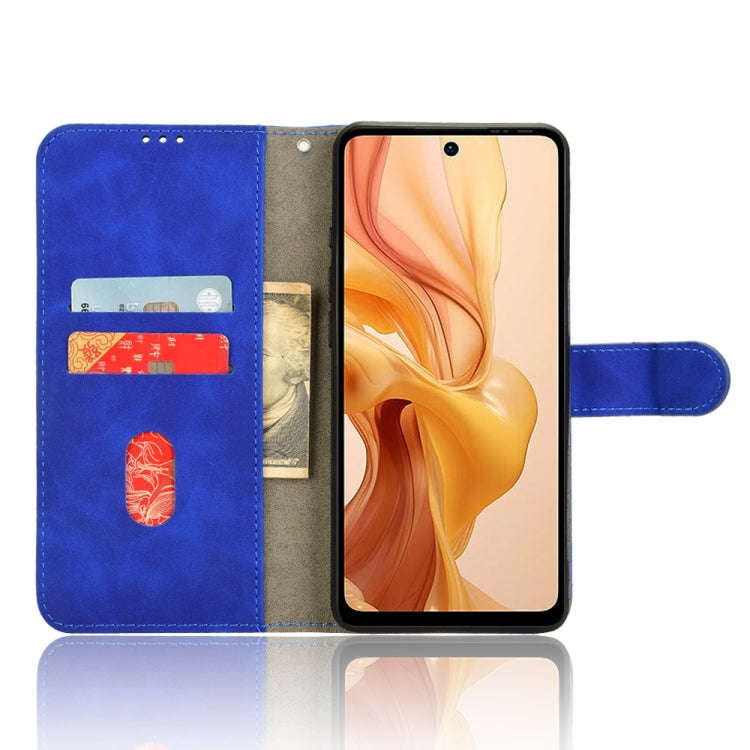 For Ulefone Note 18 Ultra Skin Feel Magnetic Flip Leather Phone Case(Blue)