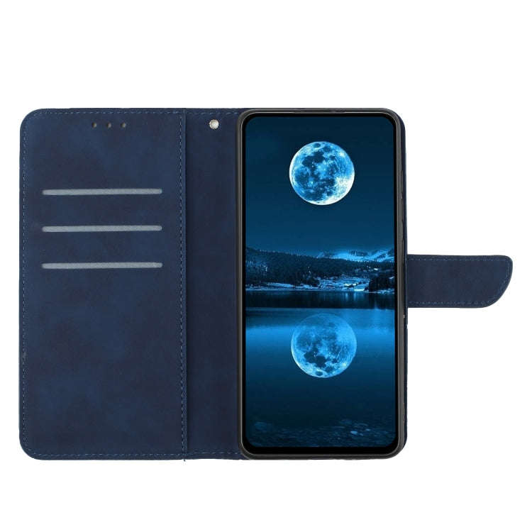 For Honor X6b Stitching Embossed Leather Phone Case(Blue)