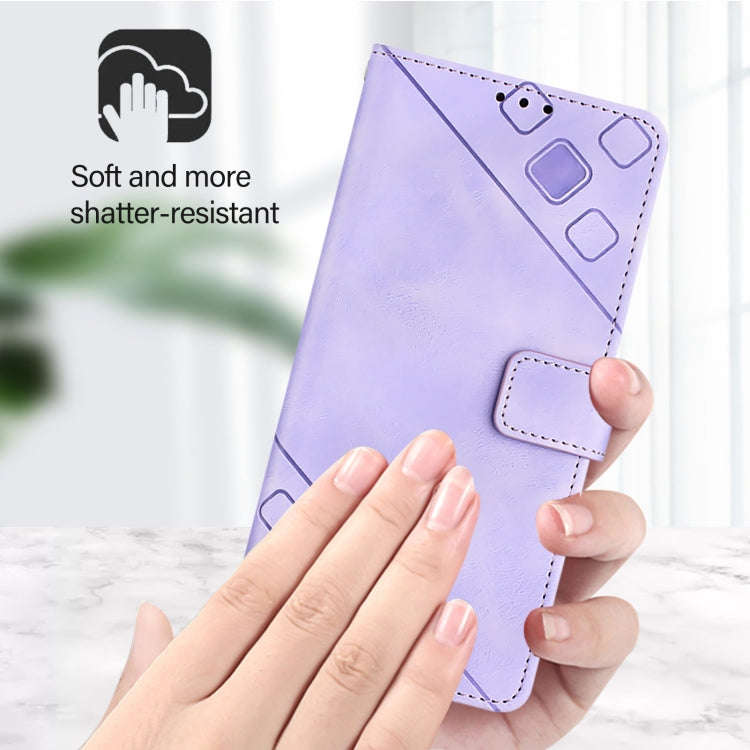For Honor X6b Skin-feel Embossed Leather Phone Case(Light Purple)