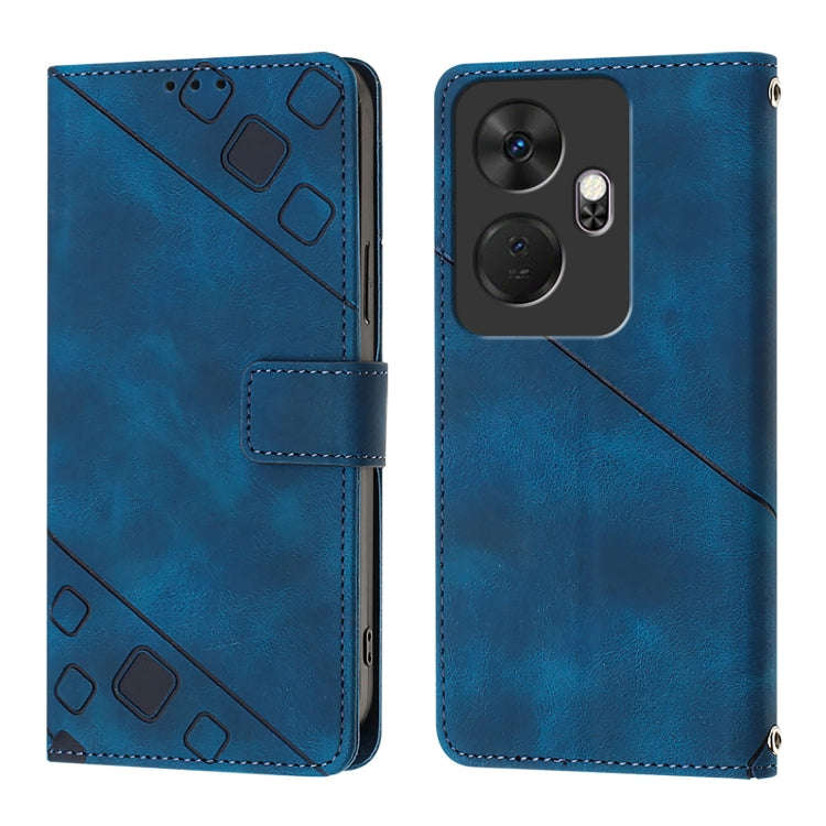 For Itel P55+ Skin Feel Embossed Leather Phone Case(Blue)