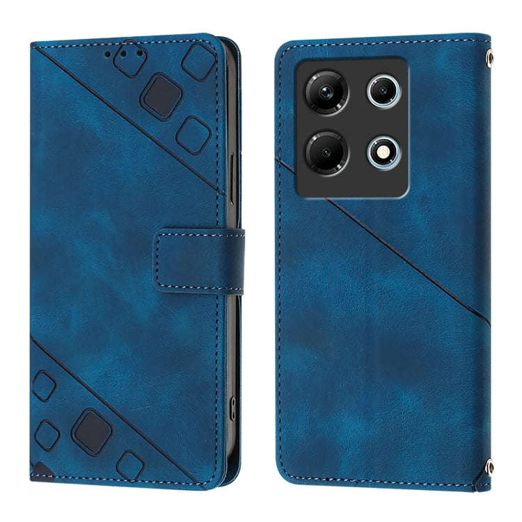 For Infinix Note 30 4G X6833B Skin Feel Embossed Leather Phone Case(Blue)