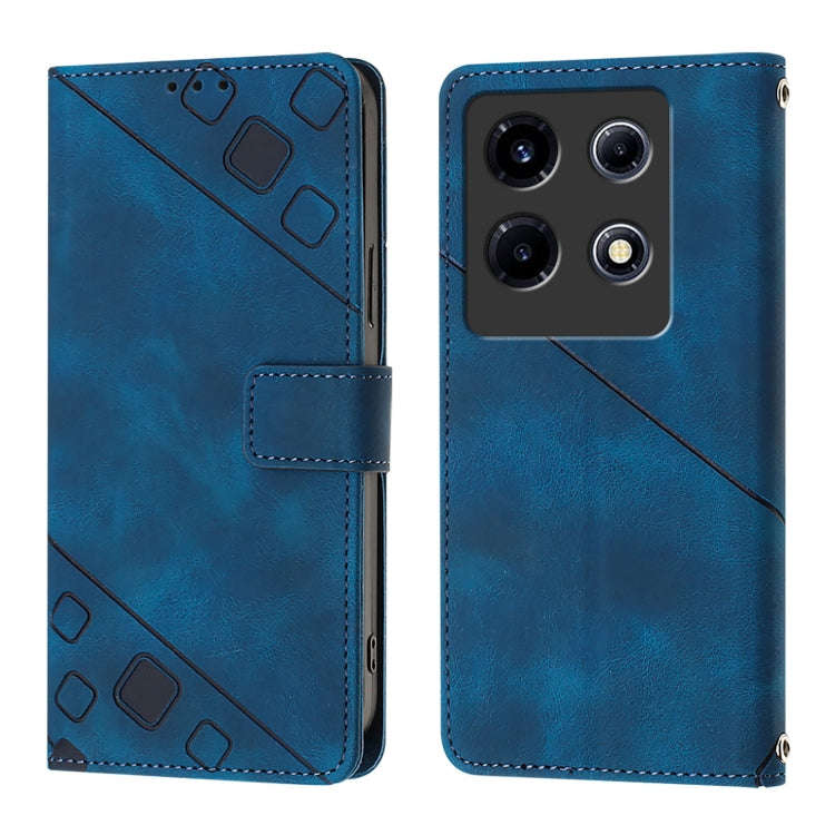 For Infinix Note 30 VIP Skin Feel Embossed Leather Phone Case(Blue)