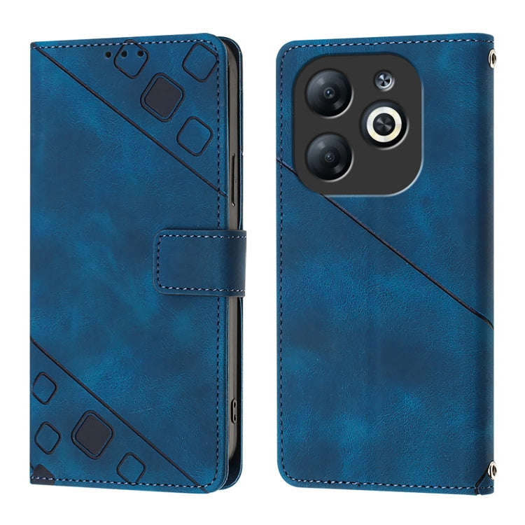 For Infinix Smart 8 Skin Feel Embossed Leather Phone Case(Blue)