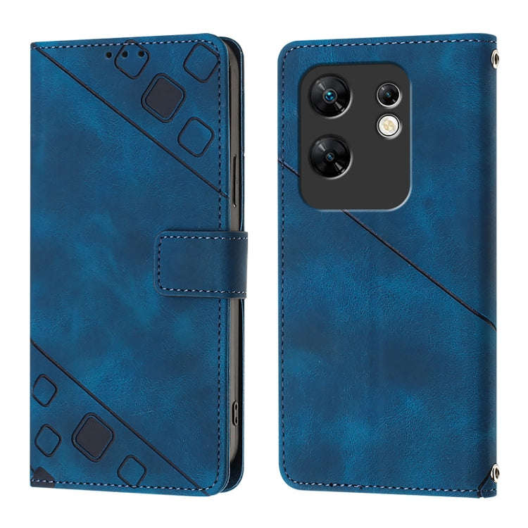 For Infinix Zero 30 4G Skin Feel Embossed Leather Phone Case(Blue)
