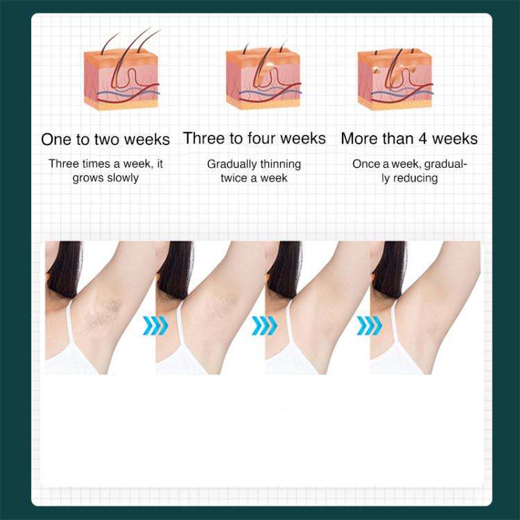 FY-B501 Laser Hair Removal Device Home Electric IPL Intense Pulse Hair Remover, EU Plug(White)