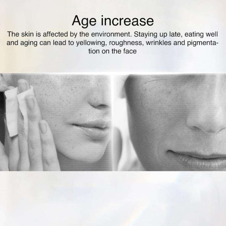 AF-101 Home Milk Light DPL Freezing Point Photon Skin Rejuvenation Device, EU Plug(Black)