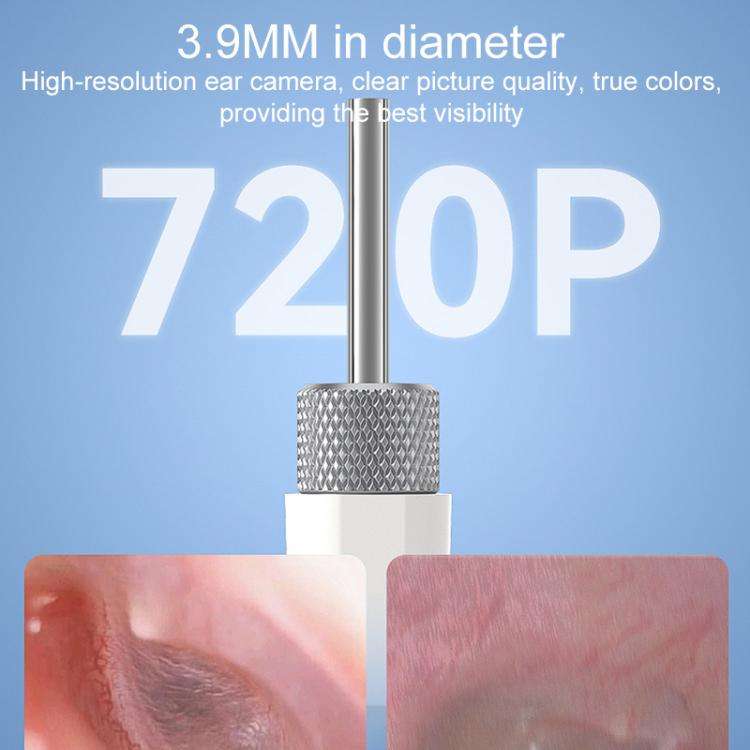 TESLONG SA160 1.45 Inch HD Screen Handheld Smart Visual Otoscope(White)