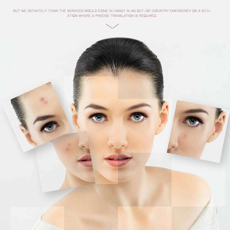 SONGSUN X2 Professional Portable Skin Spot Tattoo Freckle Removal Machine Mole Dot Removing Laser...