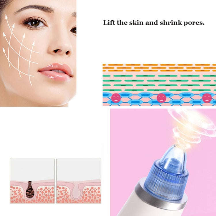 5W 1A Multi-function Blackhead Extractor Pore Cleanser with Four Probes (Blue)